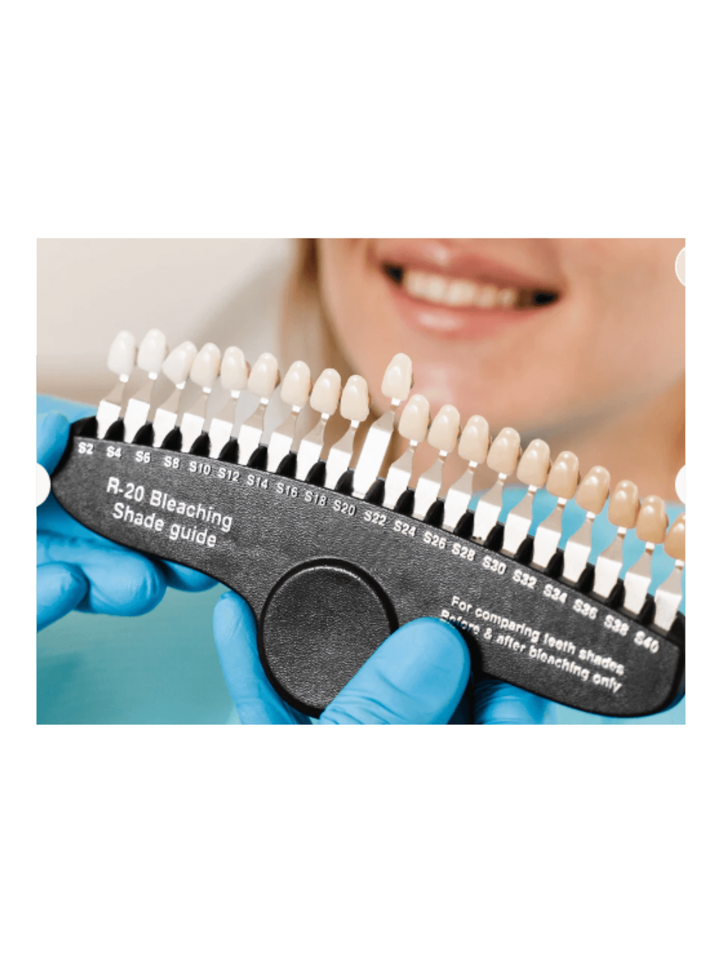 teth whitening shade guide