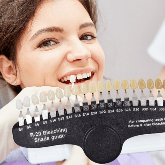 In the background a smiling lady with her mouth open showing her teeth comaring the teeth colours with a cosmetic teeth whitening shade guide in the foreground.