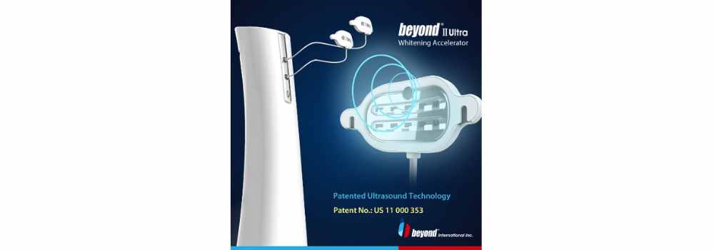Unlock Superior Results with Ultrasound Enhanced Teeth Whitening Lamps