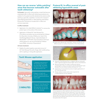 Booklets x 2  White Spot Lesions / Tooth Lightening FREE download