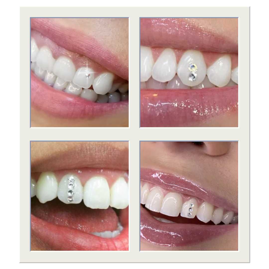 Tooth Gem | Tooth Jewellery complete application Kit – Tri-Dente