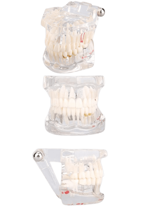 Teeth Model